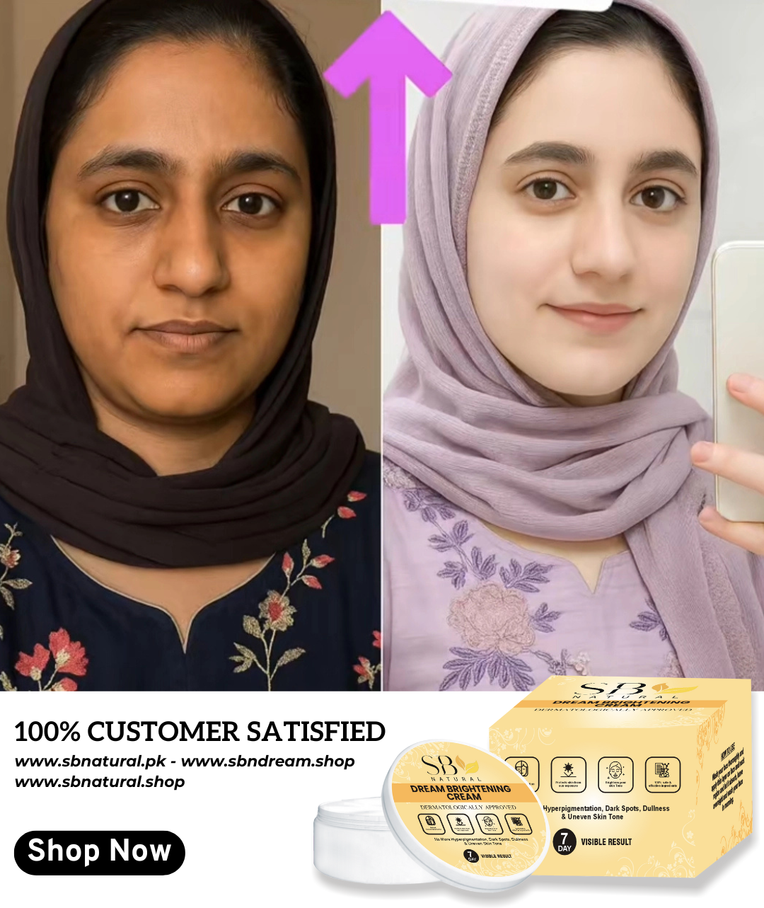 Best Seller SB Natural